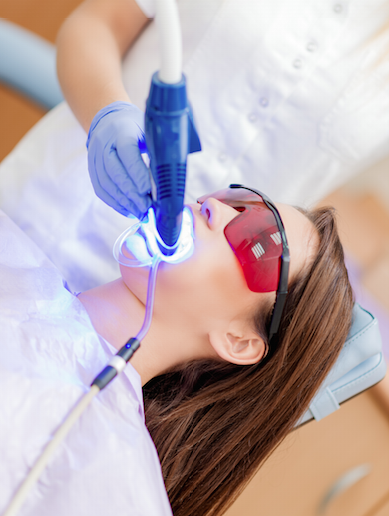 Teeth whitening by a dentist